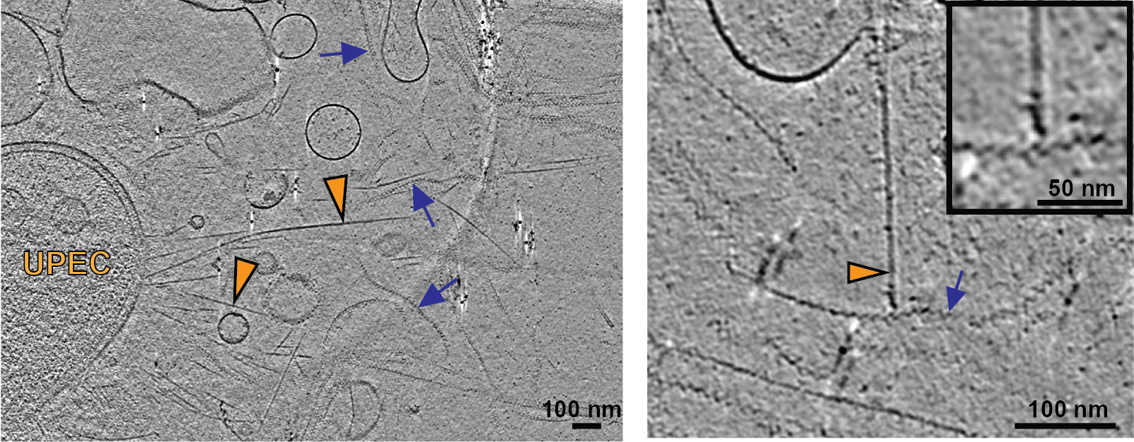 CryoET of patient samples 